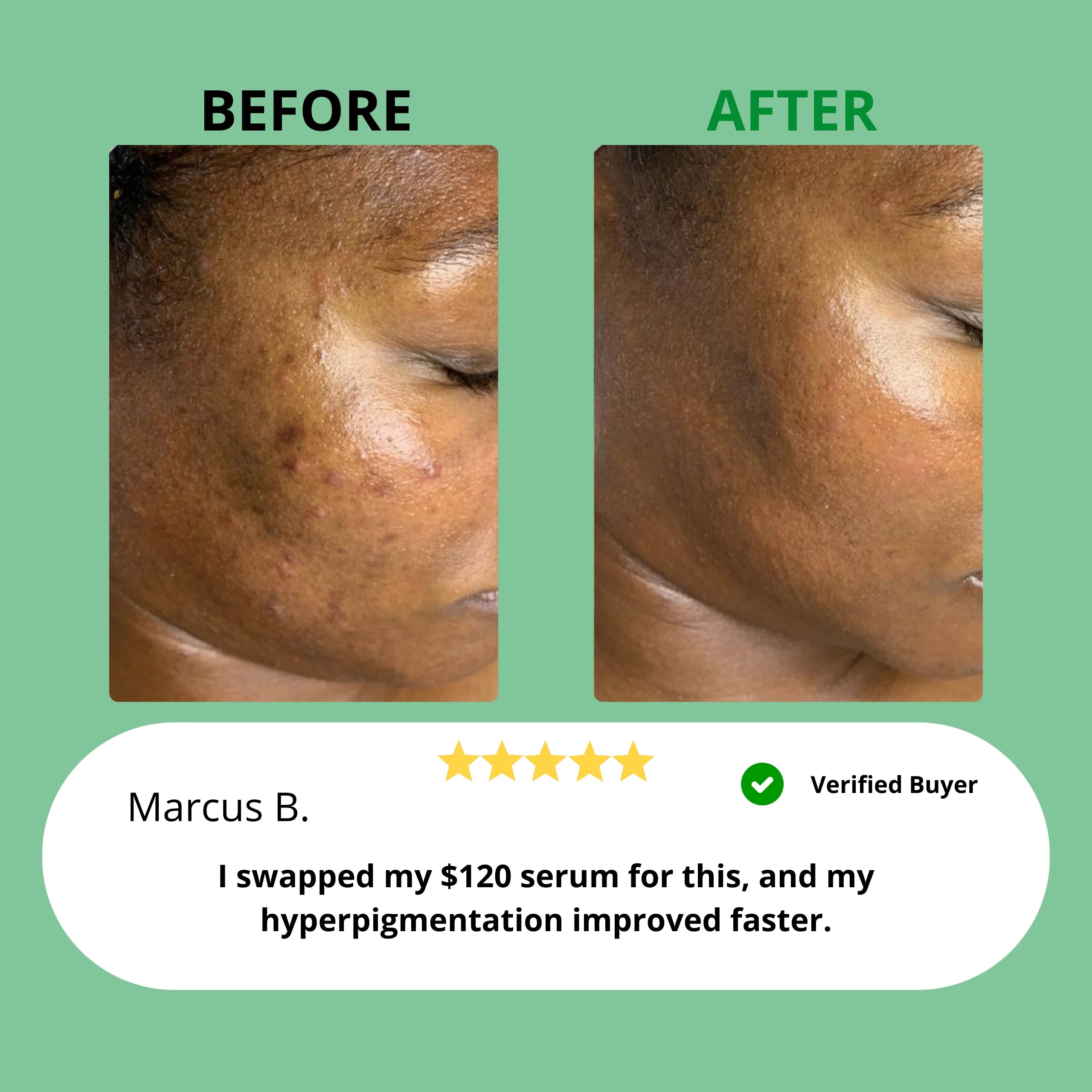 Dark Spot Serum for Sensitive Skin