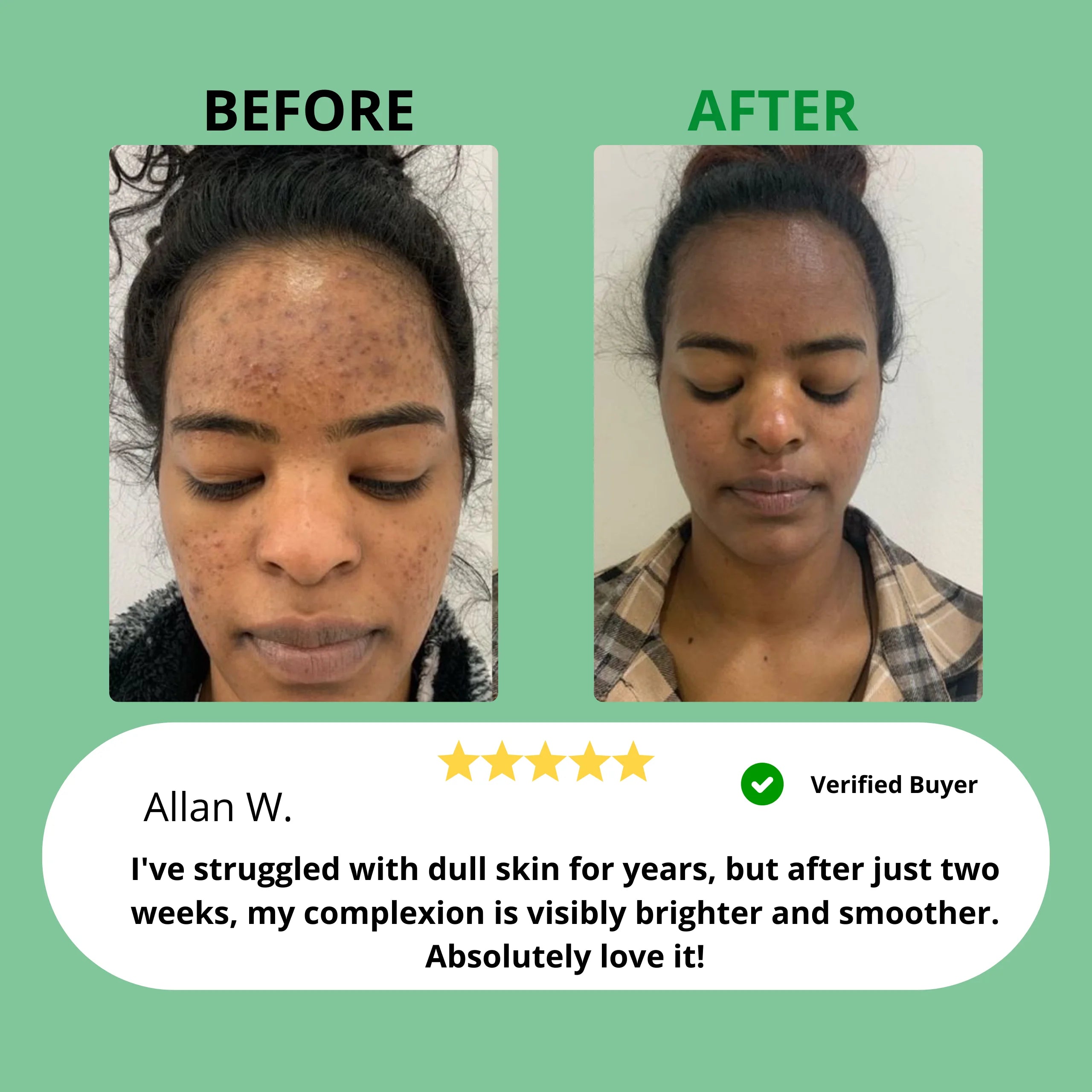 Kojic Acid & Turmeric Soap