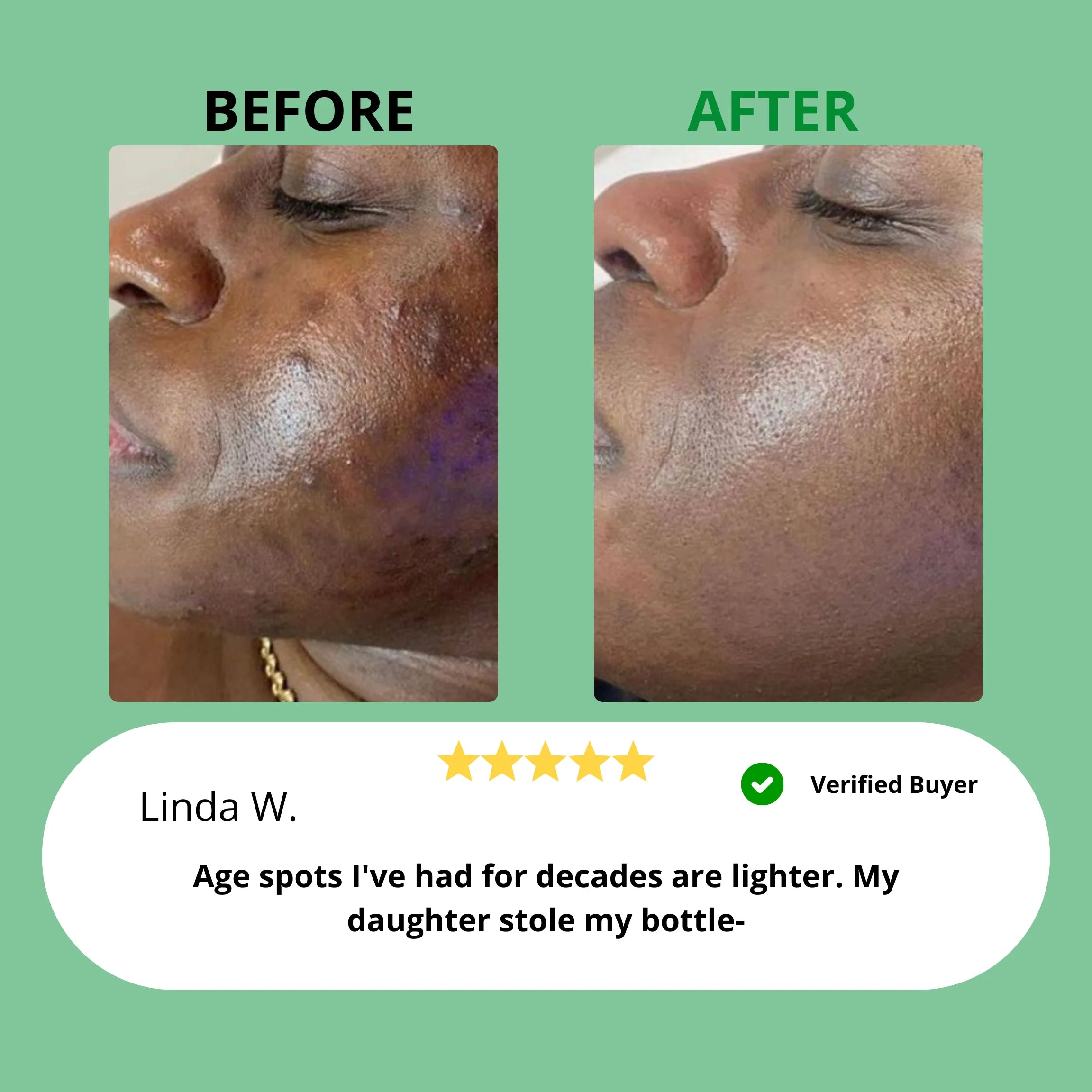 Dark Spot Serum for Sensitive Skin