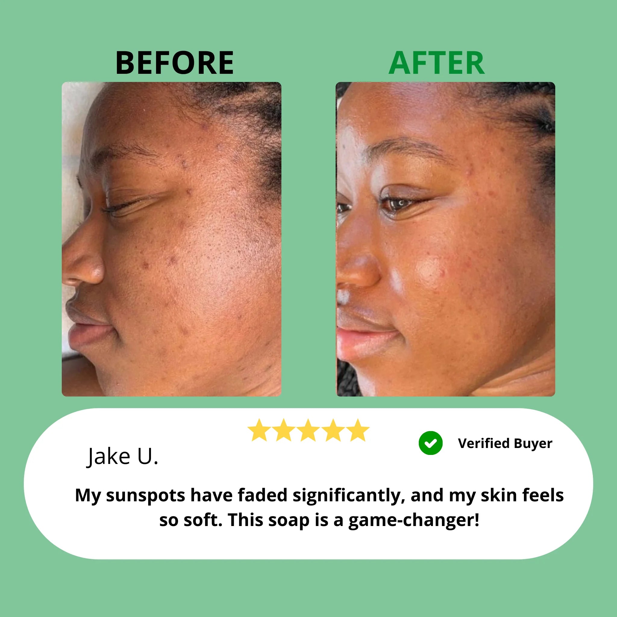 Kojic Acid & Turmeric Soap