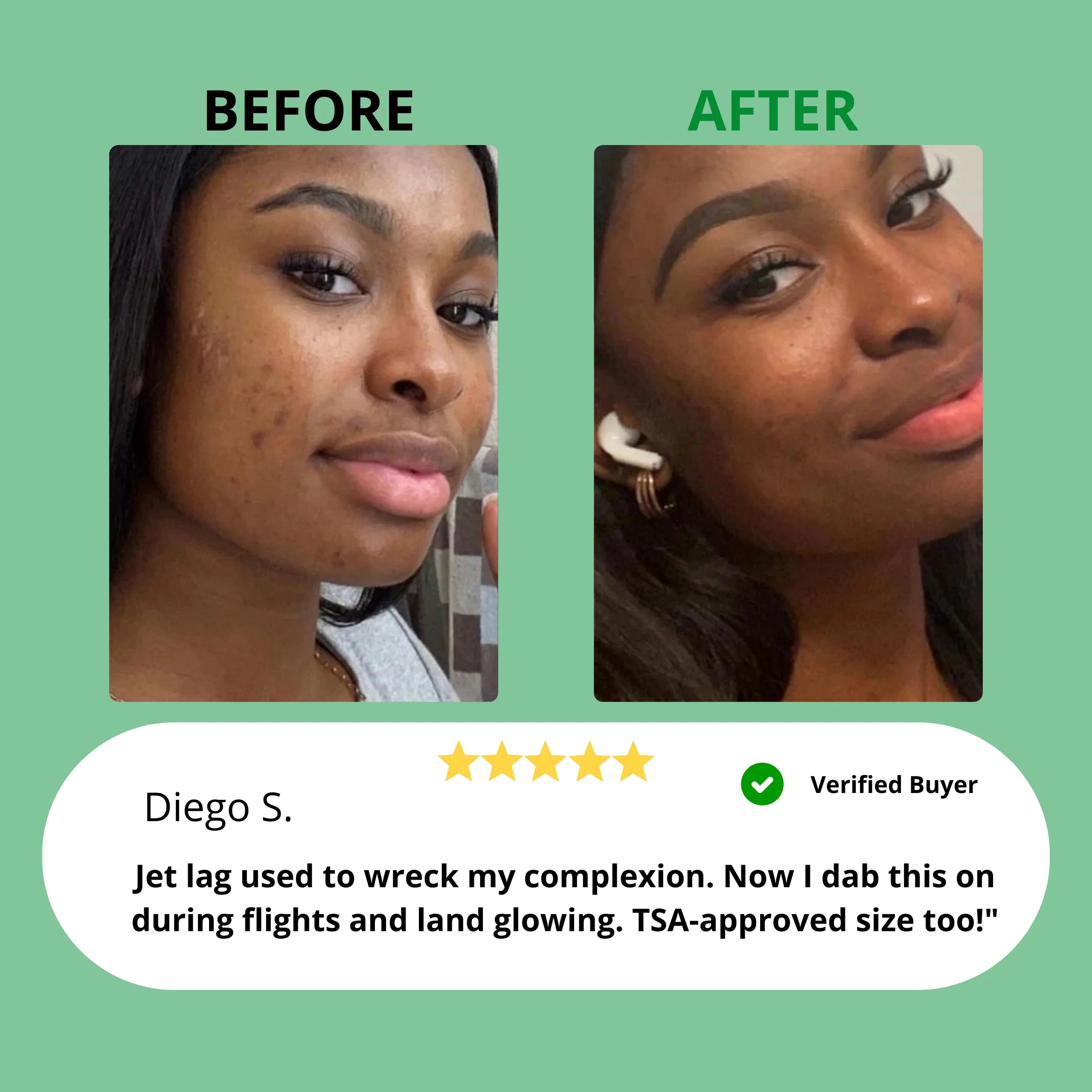 Dark Spot Serum for Sensitive Skin