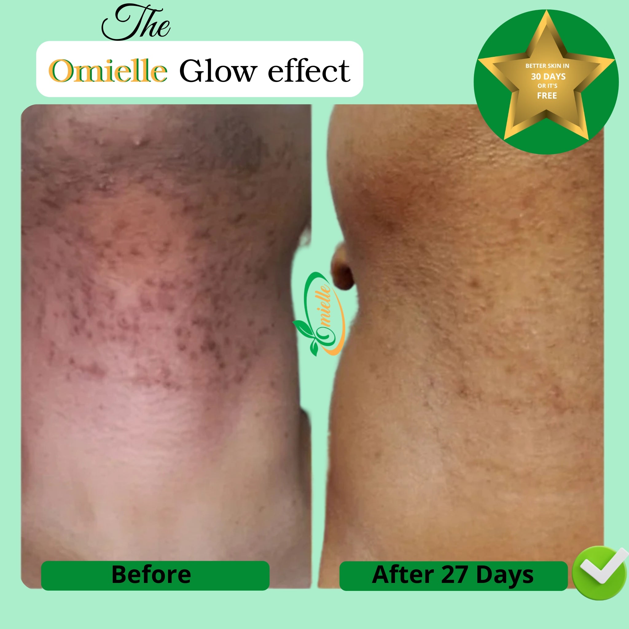 Kojic Acid & Turmeric Soap