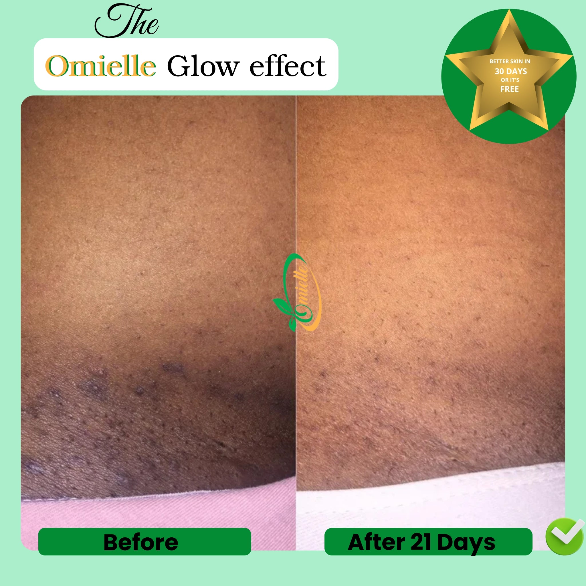 Kojic Acid & Turmeric Soap