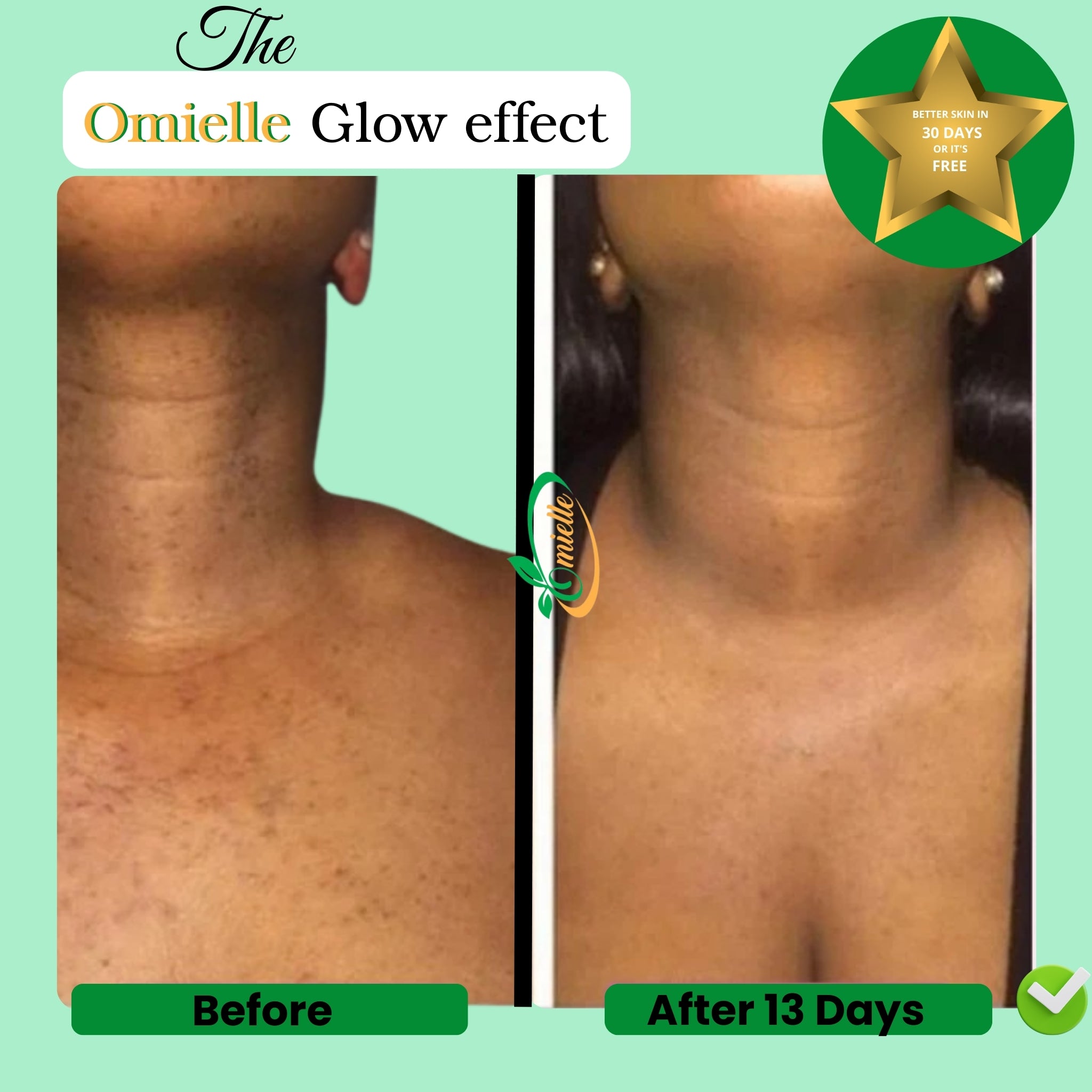 Kojic Acid & Turmeric Soap