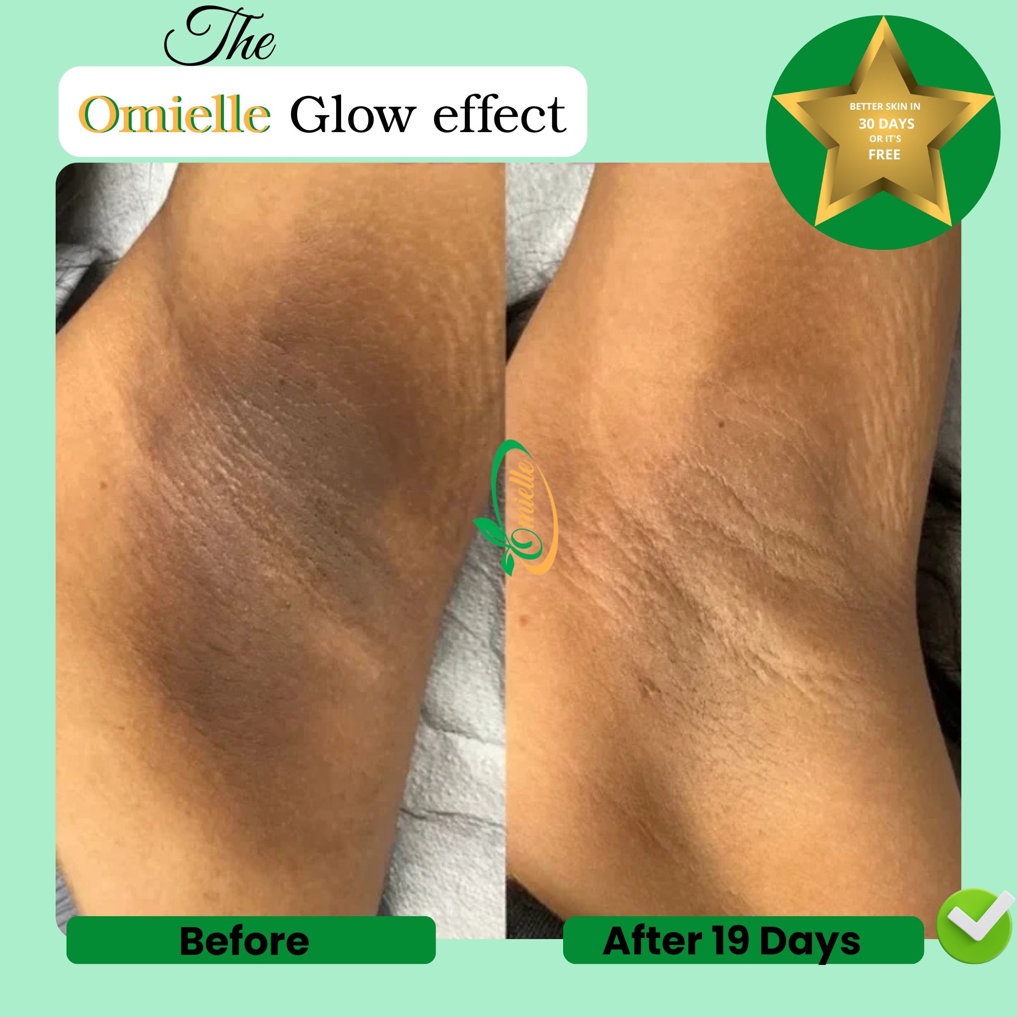 Kojic Acid & Turmeric Soap