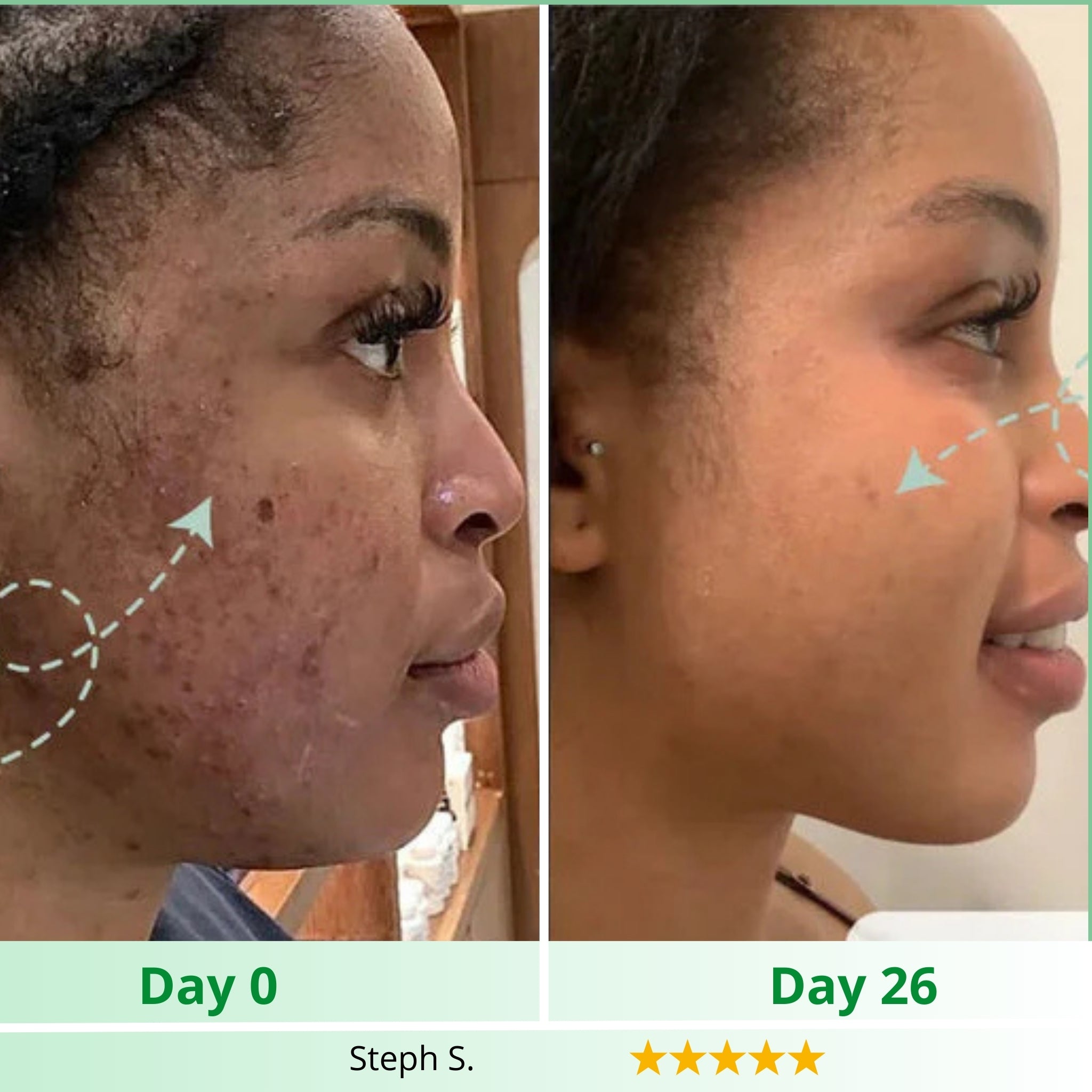 Fade Dark Spots. Reveal Your Natural Glow.